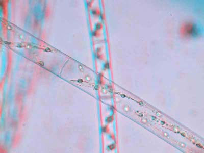 Anaglifo di Spirogyra